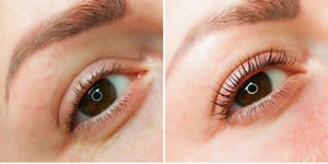 Lash Lifting